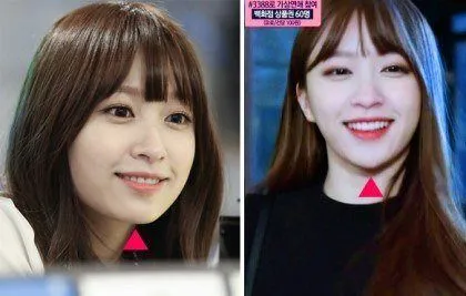 Bentuk dagu Hani EXID diduga telah oplas. © koreaboo.com