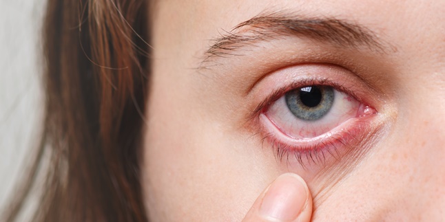 10 Natural, Effective, and Easy Ways to Treat Eye Pain