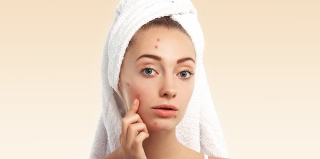 12 Causes of Stubborn Acne on the Face, Could be Due to Wrong Eating Patterns