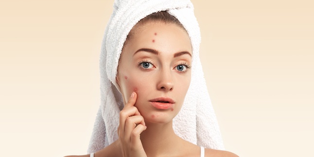 15 Natural Ways to Get Rid of Acne, Easily and Quickly