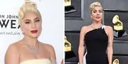 Lady Gaga Tuangkan Kisah Pengalaman Hidupnya dalam Album Baru, Bakal Rilis Tahun Depan