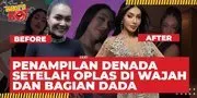 Penampilan Baru Denada Setelah Oplas Wajah dan Bagian Dada, Terlihat Muda - Keriput Hilang
