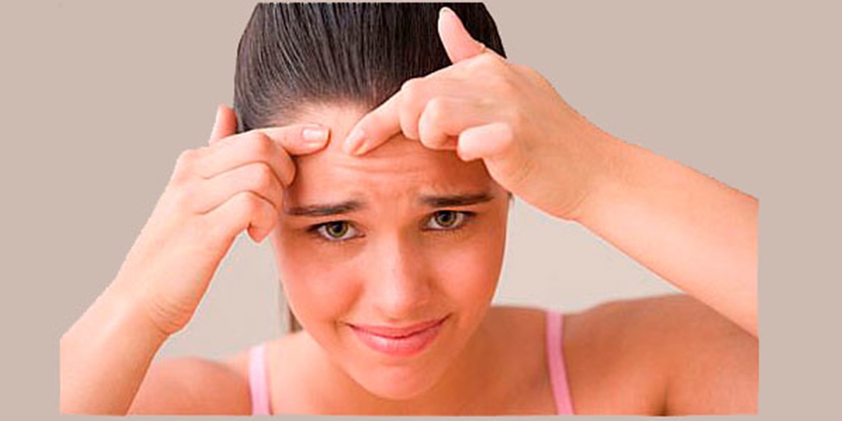 4 Meanings of Acne on the Forehead According to Javanese Primbon, Is it Really a Sign of Good Luck?