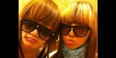 Min miss A Cidera Leher