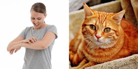 5 Bahaya Kutu Kucing Pada Manusia, Serta Cara Penanganannya 