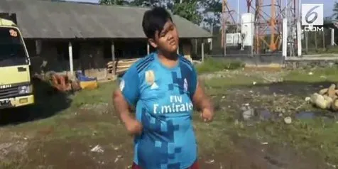 Arya Permana Bocah Obesitas Asal Karawang Kini Berhasil Turun 83 Kg