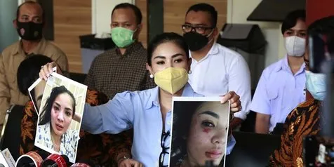 Askara Parasady Ditetapkan Sebagai Tersangka Tindak Penganiayaan Terhadap Nindy Ayunda