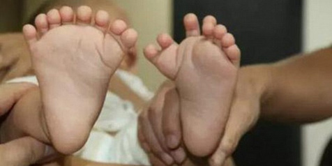 Astaga Bayi Ini Lahir Dengan 15 Jari Tangan 16 Jari Kaki Kapanlagi Com