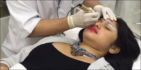 Habis Sulam Alis, Bianca Liza Lebih Percaya Diri