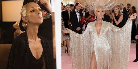 Makin Kurus Kering Begini Kondisi Tubuh Celine Dion Di Usia 51 Tahun Kapanlagi Com