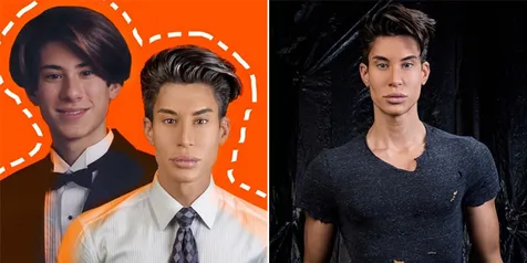 Oplas Ratusan Kali, Ini Curhatan Human Ken Doll Justin Jedlica
