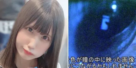 Sasaeng Fans Ini Temukan Rumah Idolanya dari Pantulan Bola Mata dalam Foto Selfie