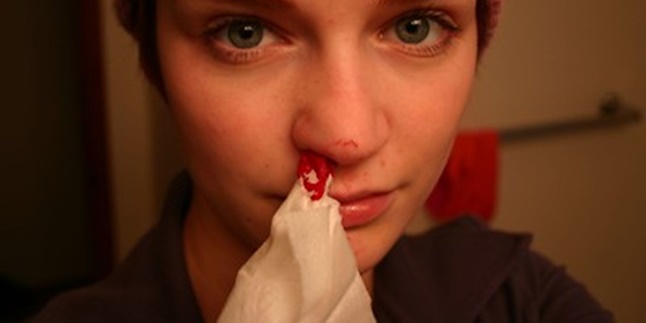 5 Ways to Easily and Quickly Overcome Nosebleeds, Also Recognize the Causes