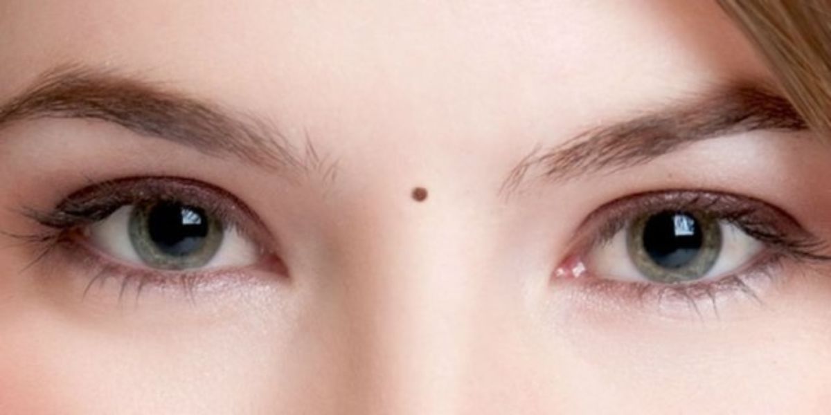 7 Meanings of Moles Based on Their Location on the Body, Can Determine Your Character and Luck