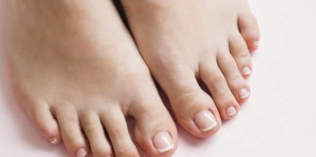 7 Ways to Treat Athlete's Foot Naturally, One of Them with Garlic.