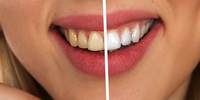 7 Causes of Yellow Teeth, Be Careful Can Be Caused by Incorrect Toothbrushing