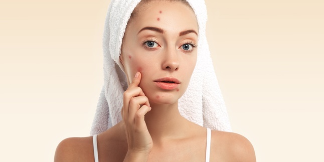 9 Ways to Remove Annoying Chickenpox Scars Naturally