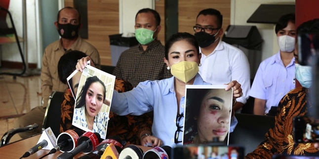 Experiencing Domestic Violence from Askara Parasady Harsono, Nindy Ayunda's Mother: Her Whole Body is Bruised