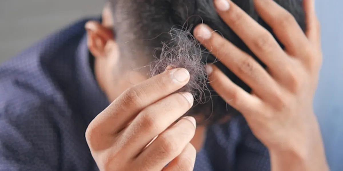 Meaning of Dreaming About Losing a Lot of Hair: Symbols of Change and Anxiety