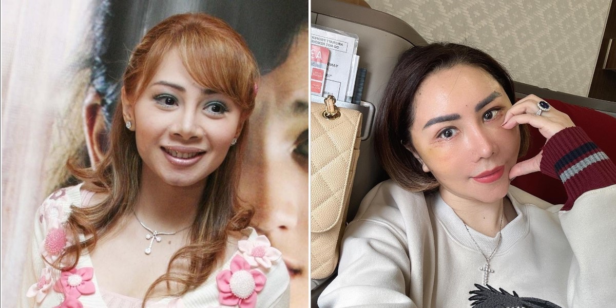 From Face Lifts to Liposuction, Here’s Why Femmy Permatasari Continues to Have Plastic Surgery