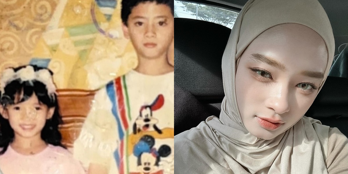 Accused of Plastic Surgery - Whitening Injection, Inara Rusli Shares Childhood Photos with Her Mixed-Race Parents