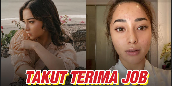 Because of Severe Acne, Nikita Willy Cries Every Night