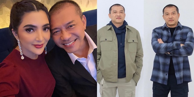 Looking Younger, Here are 7 Latest Portraits of Anang with Growing Hair after Transplantation in Turkey