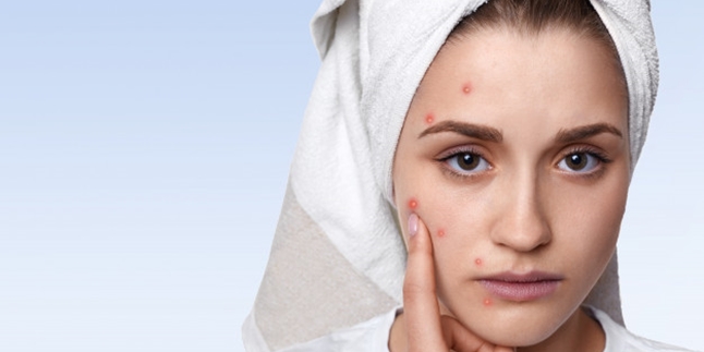 Don't Underestimate, These 7 Acne Positions on Your Face Can Indicate Your Health Problems