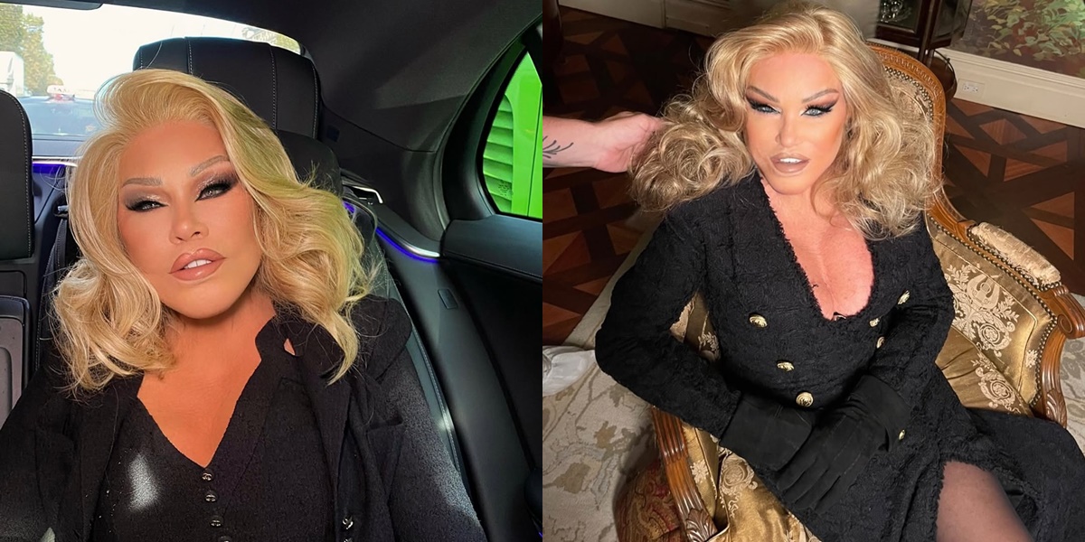 Jocelyn Wildenstein, Woman Known as Catwoman Passes Away