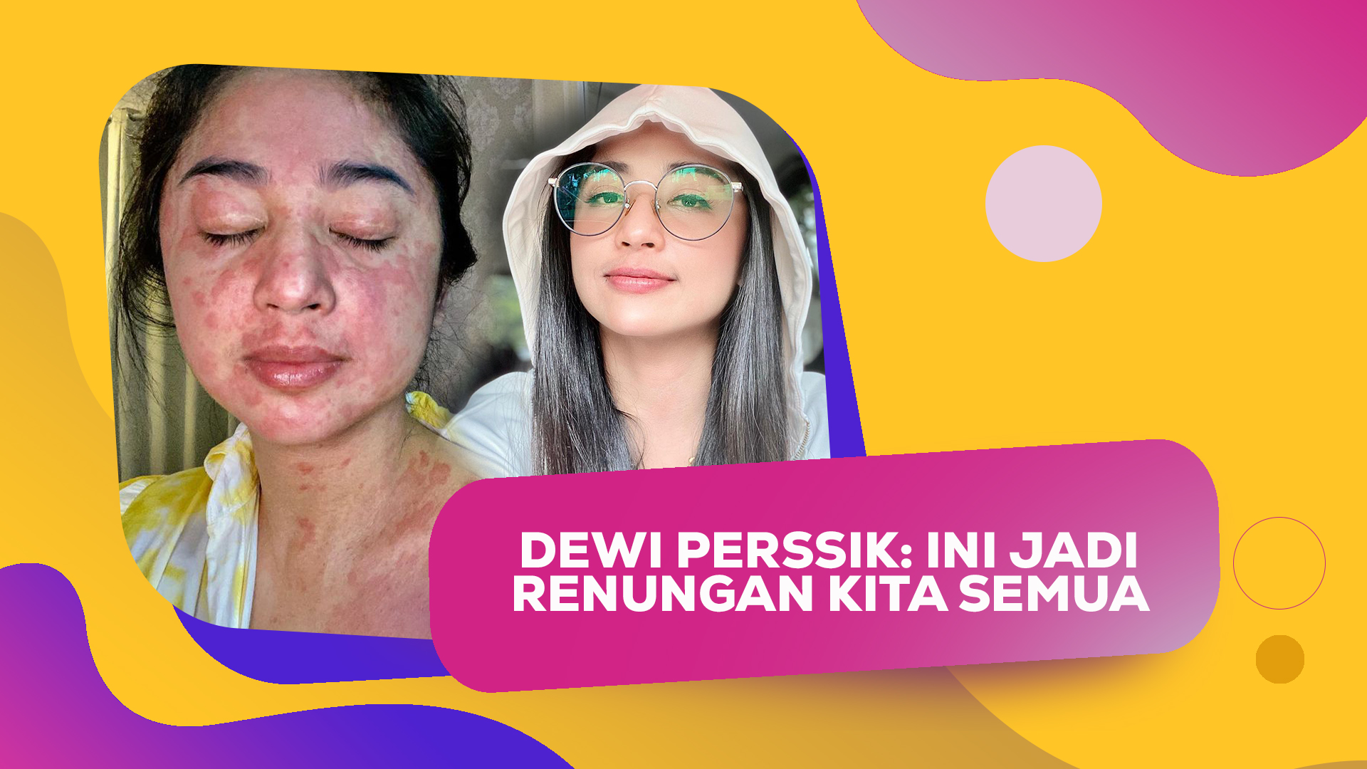 Disappeared for 1 Month, Dewi Perssik Recovers from Covid-19