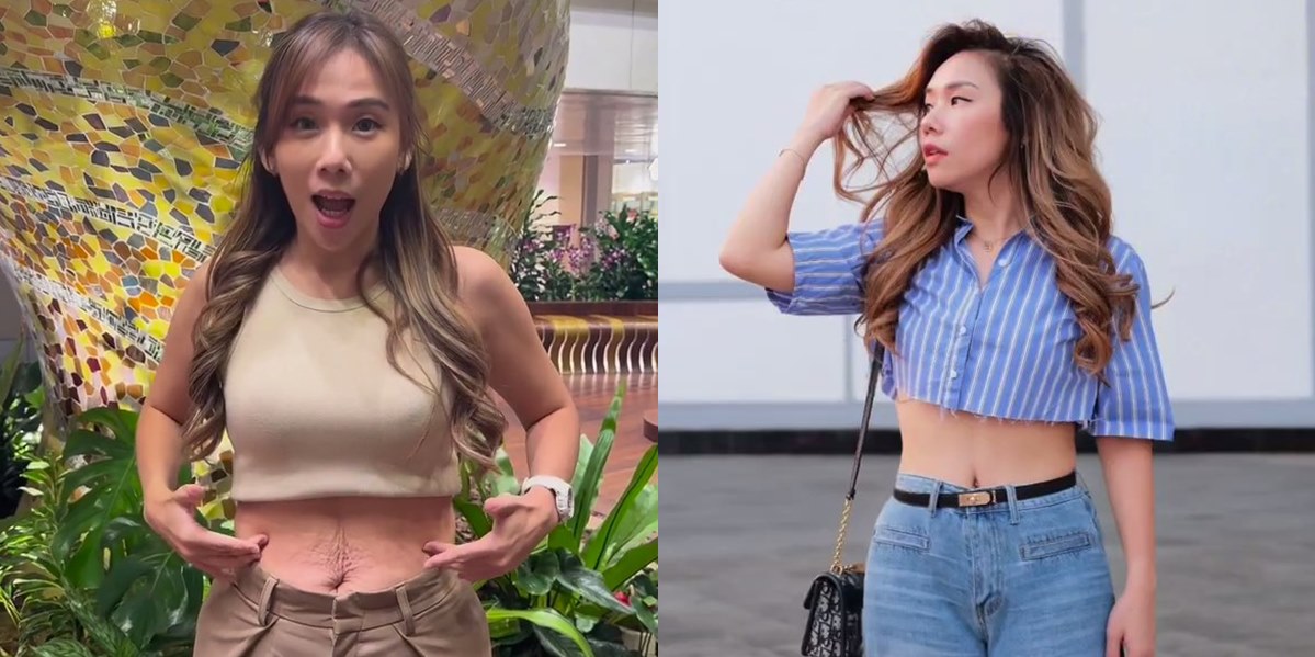 Cherly Juno's Moments Shared Before and After Tummy Tuck Surgery, The Difference is Clearly Visible