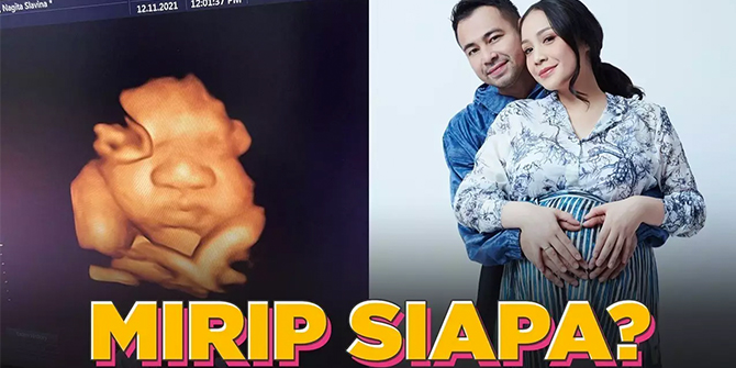 Nagita Slavina Uploads a Photo of Her Second Child's Smiling Face in the Womb, Who Does It Resemble?