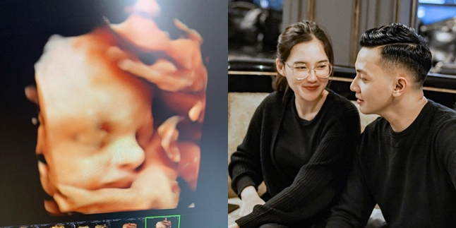 Nella Kharisma Uploads Ultrasound Photo, Baby's Nose Said to Resemble Dory Harsa