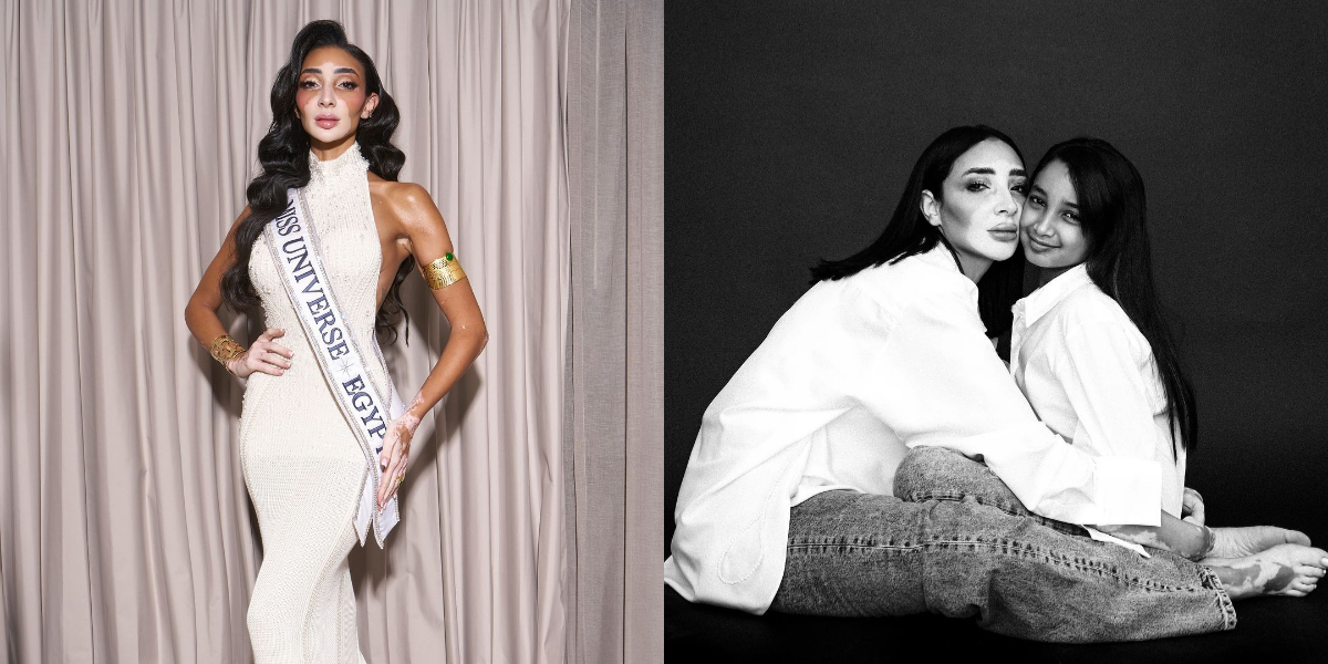 The Beautiful Portrait of Logina Salah, Egypt's First Miss Universe with Vitiligo and a Mother