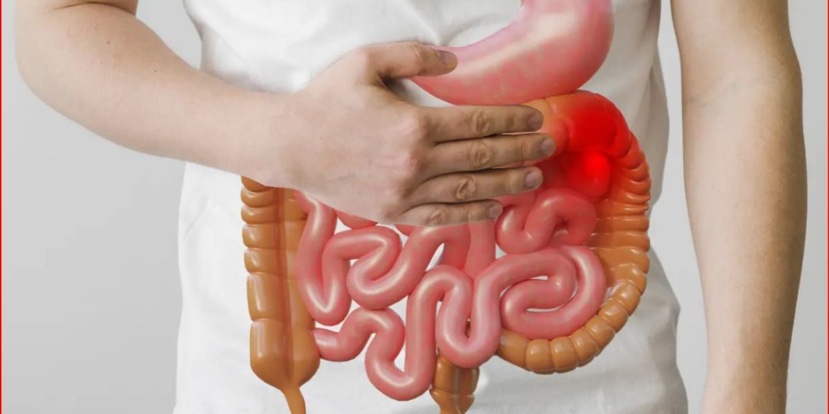 Signs of Colon Cancer: Causes, Symptoms, and Prevention Methods