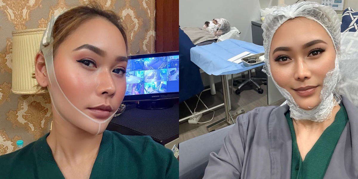 Without Plastic Surgery, Inul Daratista Undergoes This Treatment for a Slim and Youthful Face