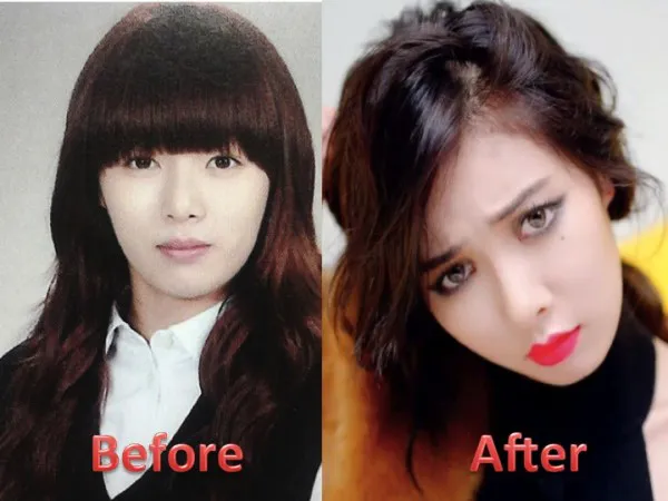 Perubahan wajah HyunA yang dianggap telah melakukan operasi plastik. @lollipop.sg