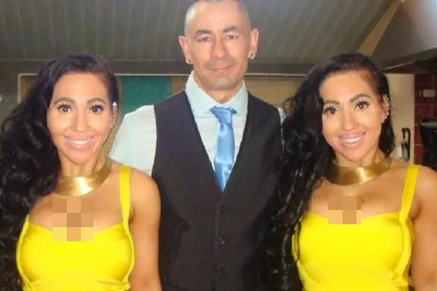 Anna dan Lucy DeCinque, saudara kembar yang berniat nikahi pria yang sama © mirror.co.uk