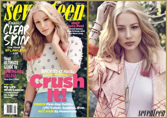 Iggy Azalea buka-bukaan soal oplas © Seventeen