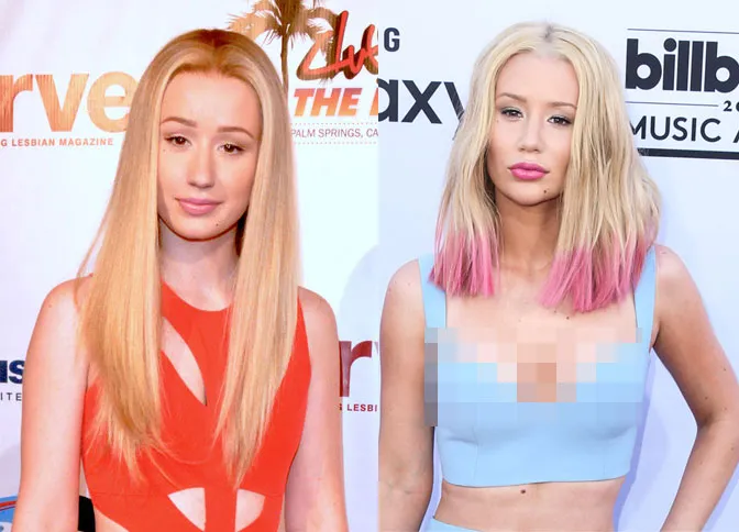 Iggy Azalea dulu dan kini © Splashnews