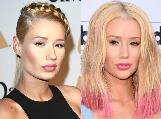 Bisa menemukan perbedaan di wajah Iggy? @ istimewa