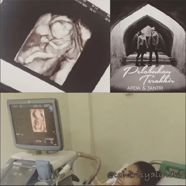 Hamil, Arda tak batasi aktivitas manggung sang istri/©instagram.com/tantrisyalindri