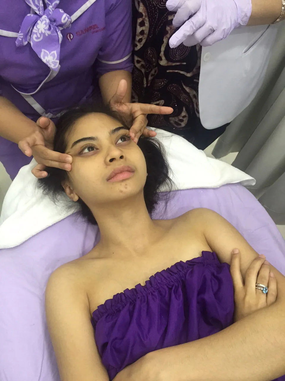 Wajah Tiwi T2 jadi jerawatan gara-gara mengonsumsi obat abal-abal © KapanLagi.com®/Sahal Fadhli