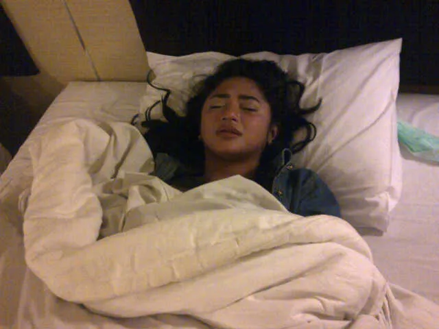 Wajah Dewi Perssik yang gosong dan diduga akibat guna-guna Foto: Manajemen Dewi Perssik