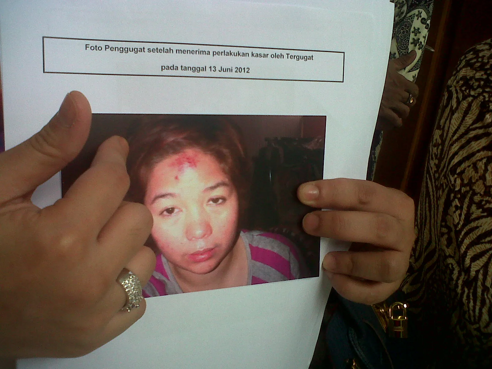 Joy mengaku kerap mendapat perlakuan kasar dari Daniel Sinambela. ©aal