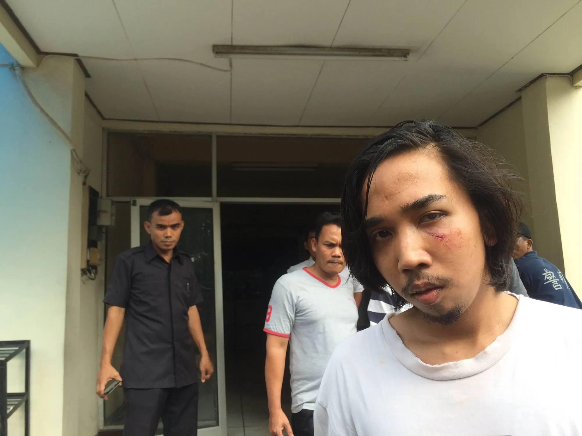 Korban pemukulan Ganindra Bimo/©KapanLagi.com®/Fikri Alfi Rosyadi