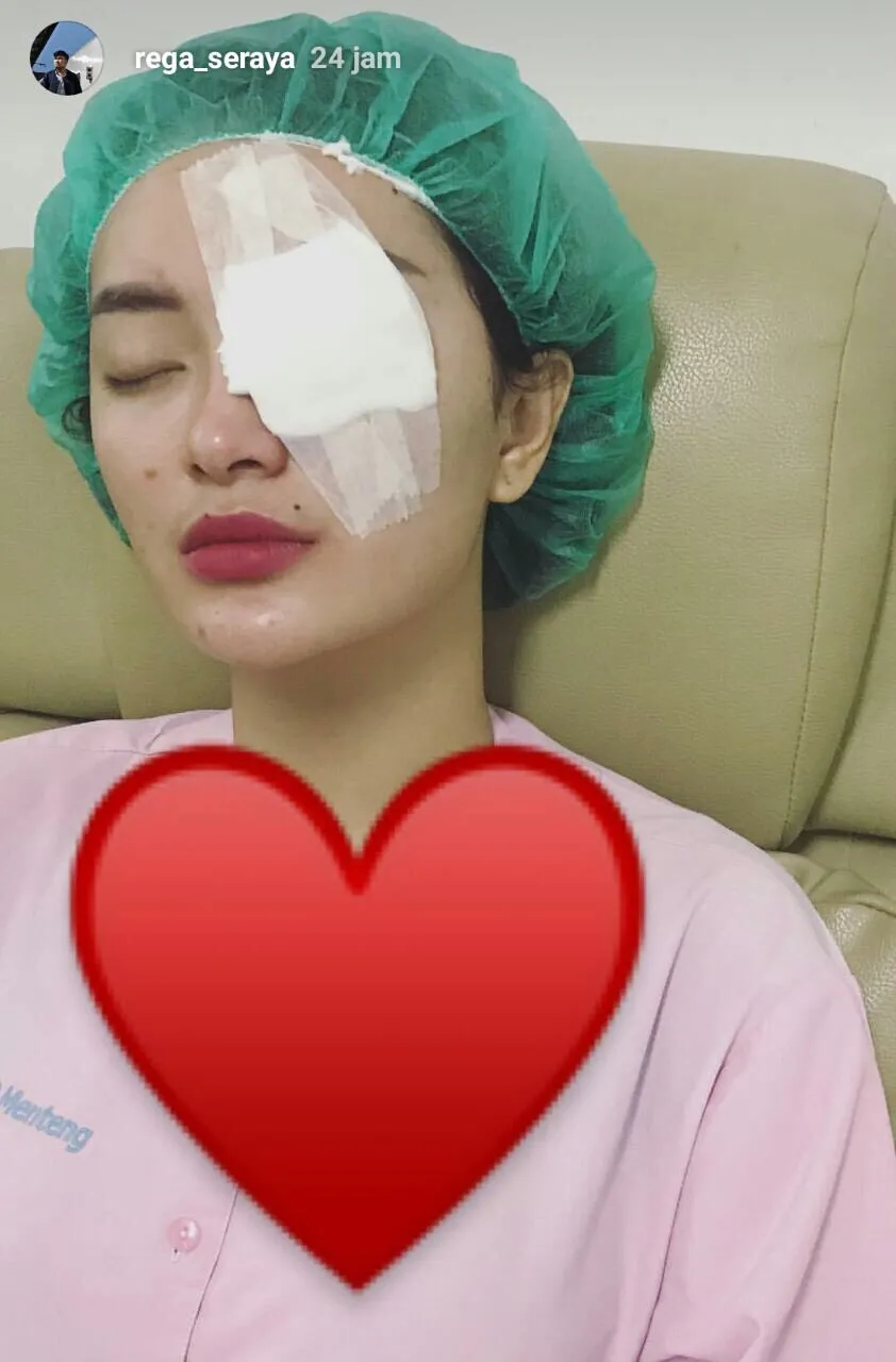 Zaskia Gotik menjalani operasi mata © Instagram.com/rega_seraya