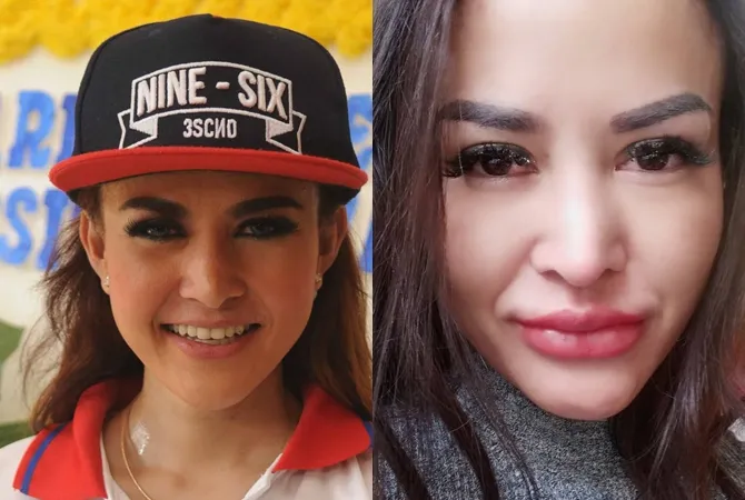 Perubahan wajah Alona, 2015 (kiri) dan 2018 (kanan). © Istimewa