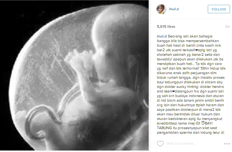 Inul Daratista curhat panjang tentang masalahnya di Instagram © Instagram.com/inul.d