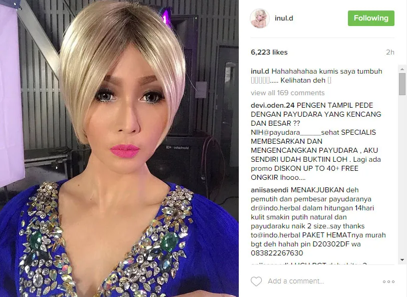 Inul Daratista tunjukkan kumis tipis yang tumbuh di wajahnya © instagram.com/inuldaratista